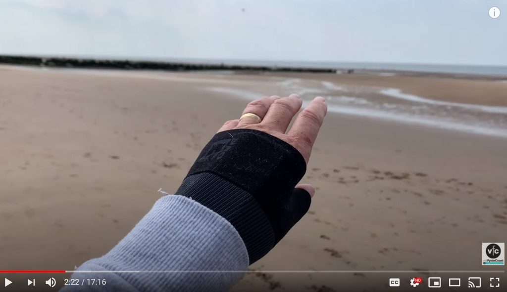 Jane's splinted wrist, what a day Thursday the 13th turned out to be!